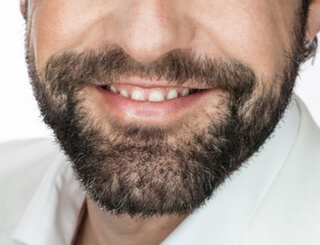 Bartwuchs anregen & beschleunigen » Minoxidil als Bartwuchs anregen & beschleunigen » Minoxidil als